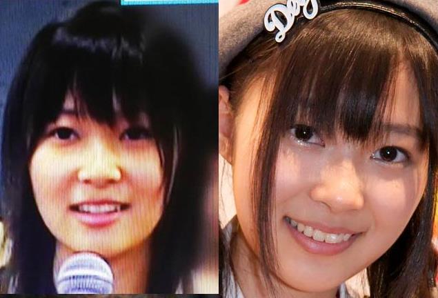 사시하라 리노 성형의혹 (9).JPG