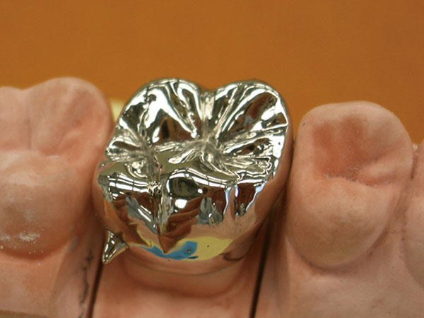 9_新東京歯科技工士学校 3 金歯づくり.jpg