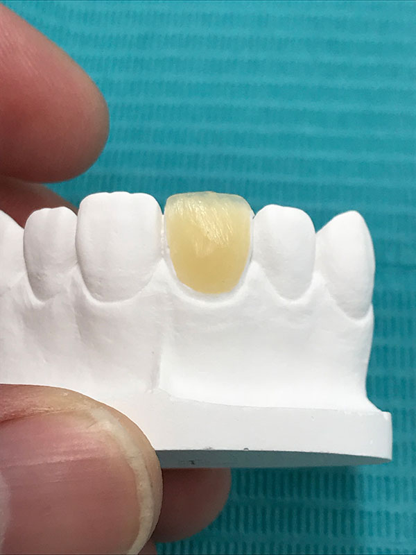 9_新東京歯科技工士学校 4 白い歯づくり.jpg